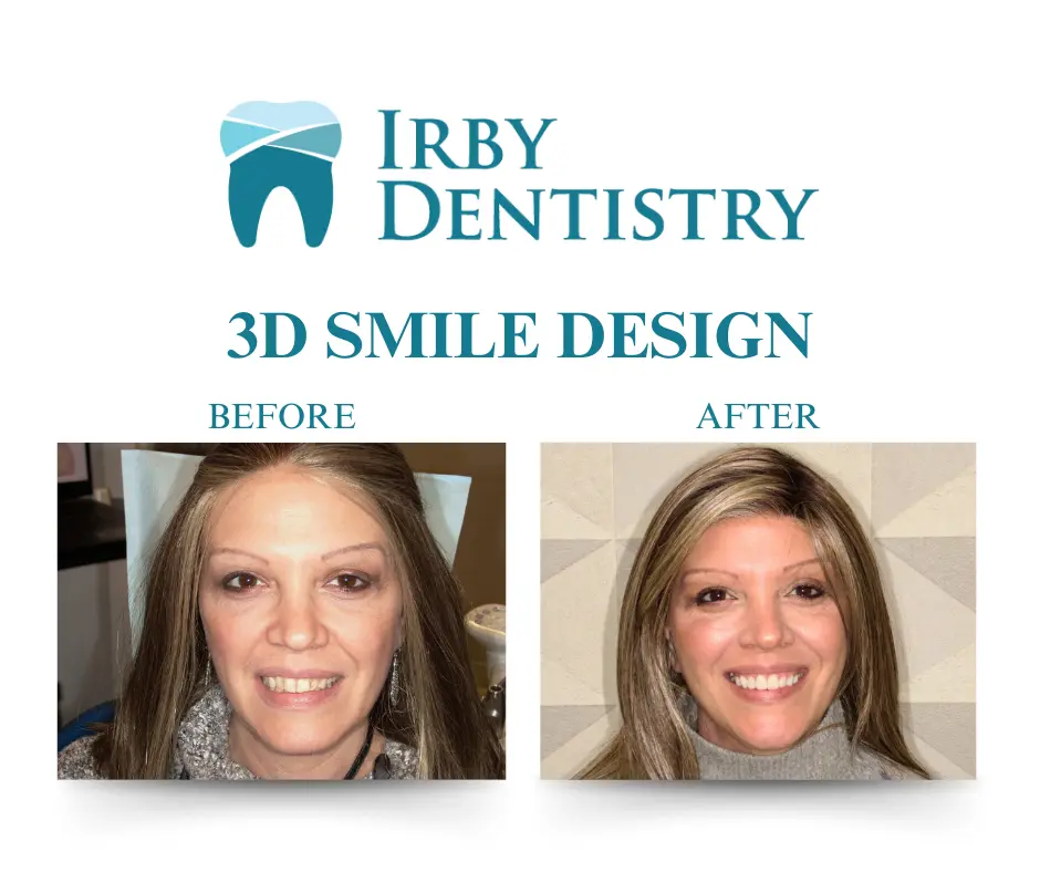 Irby Dentistry 3D Smile Design Before and After